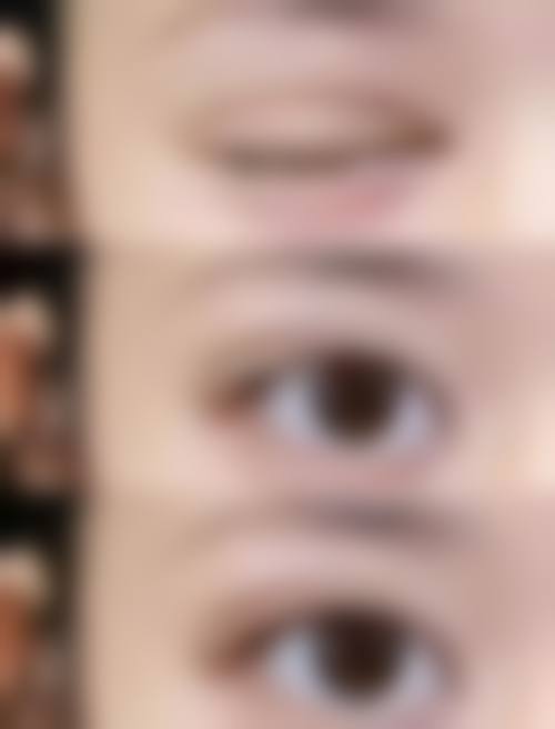 【张绍医生技术特点】