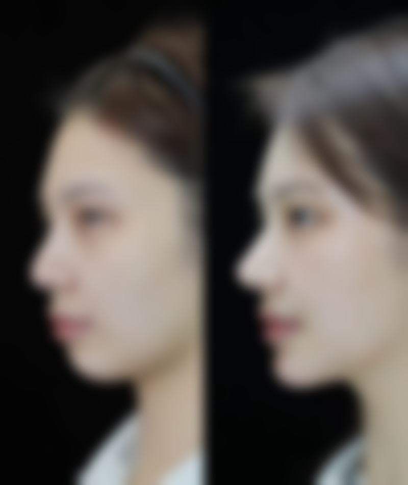 瘦脸针去哪家打好？揭秘3家口碑医美机构，专业医生、优质产品，让你安全变美！ 