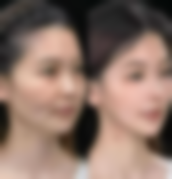 【成都市青羊区第五人民医院整形美容中 心参考价格表：】