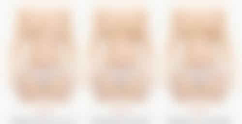 做阴道紧缩术有什么副作用