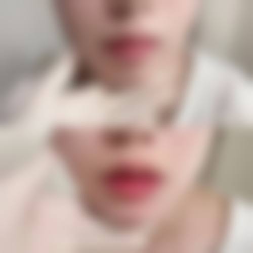 【潍坊金美仁合整形医院患者口碑评价：】