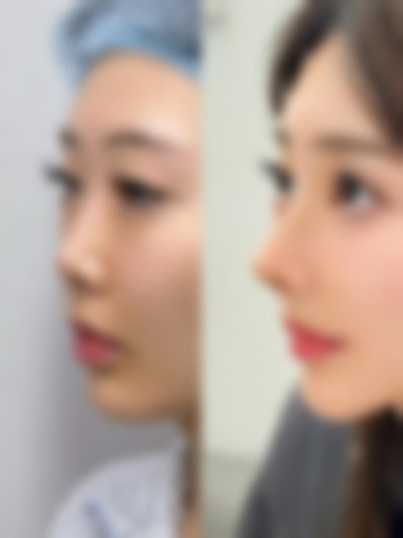 【花小金井站前Skin Clinic诊疗设备:】