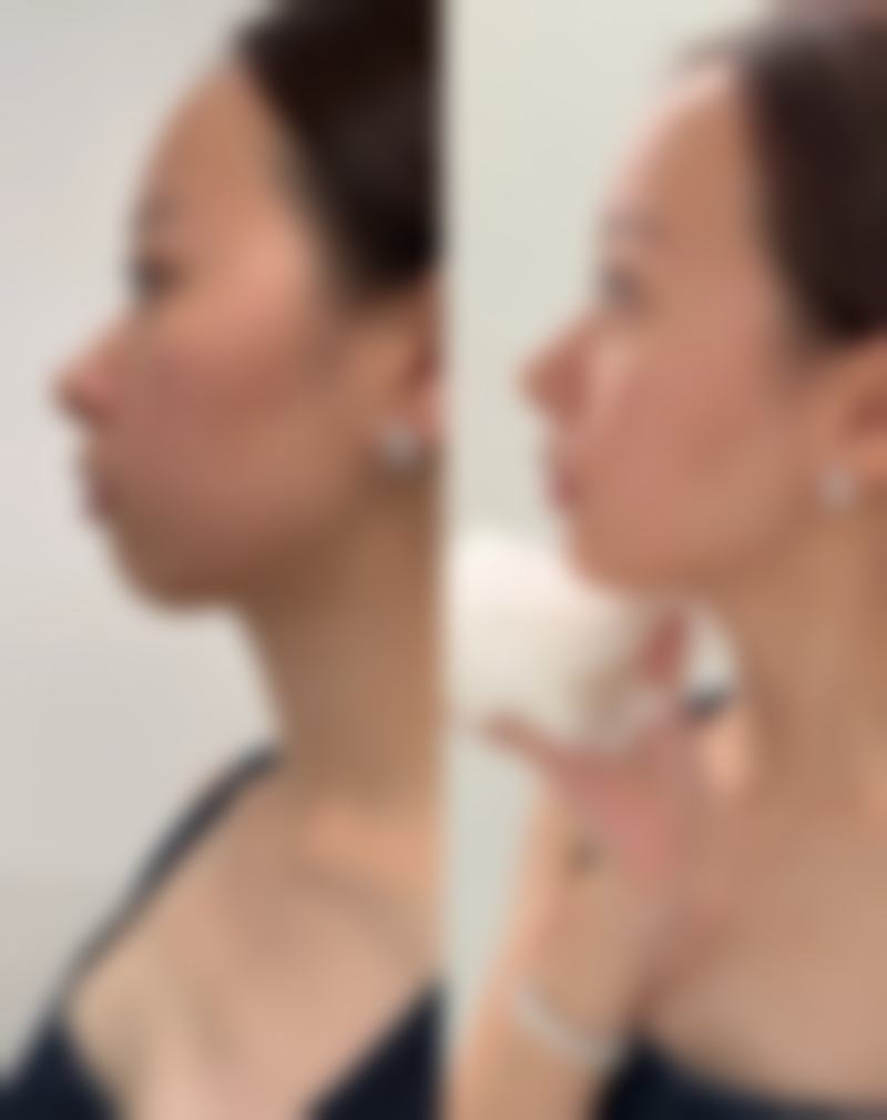 哪些明星毛发种植？深度剖析3大明星毛发种植案例，揭秘医美背后的正向效果与优势！ 