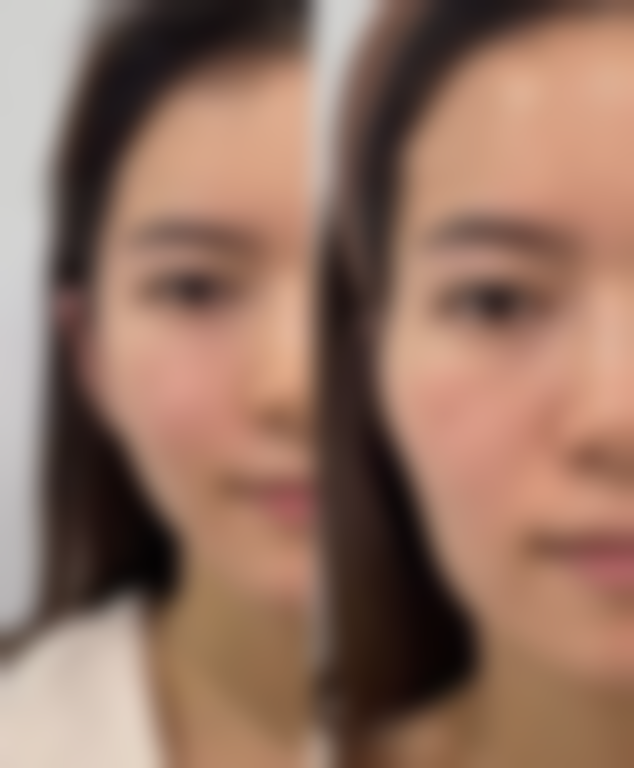 【潍坊金美仁合整形医院是正规的吗?】