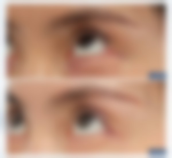 预约上海爱尚丽格医疗美容门诊部张诗若做眼部手术值不值?