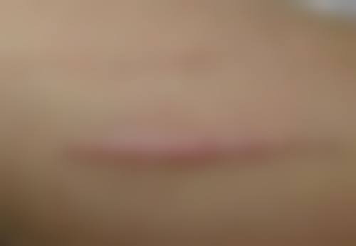 美白针哪里的成效好