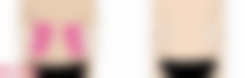 改善嘴巴凹进去下巴外凸的注意事项