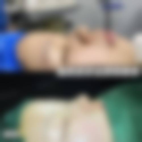 【郑浩龙医生擅长项目】