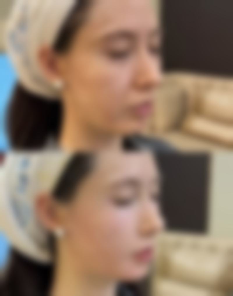 下巴歪有什么影响