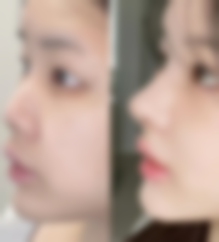 【江西省儿童医院参考价格表:】