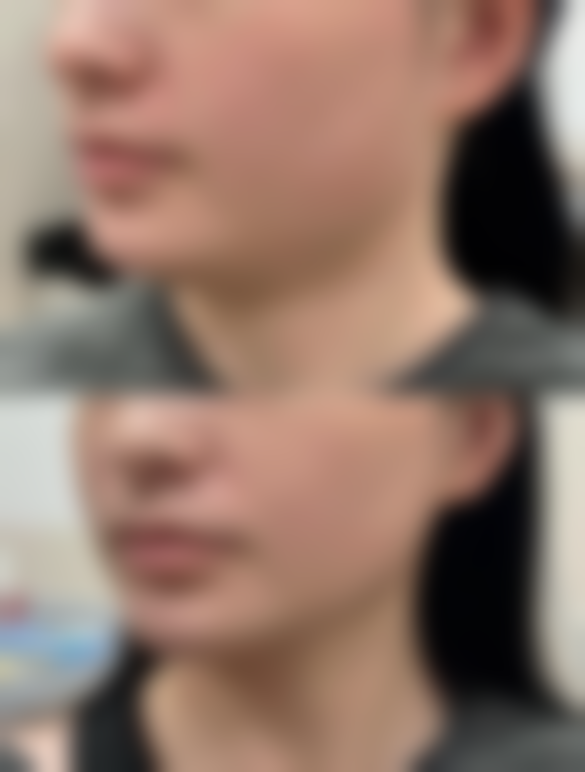 【王煜东医生口碑怎么样？】