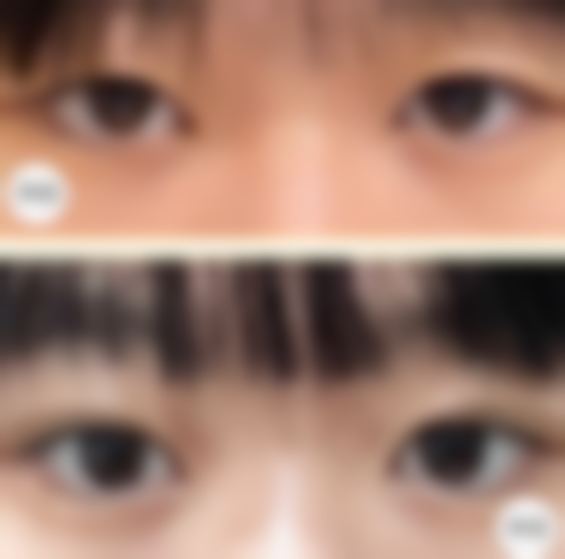 【岳伟医生擅长项目:】