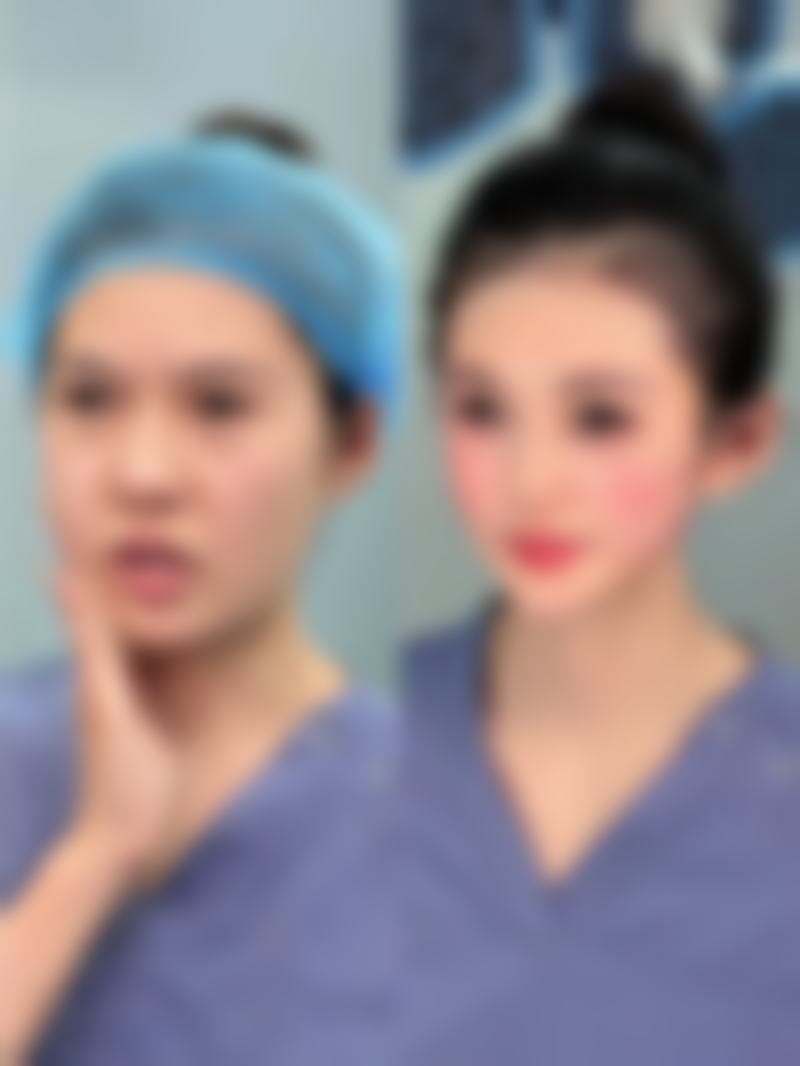 美白针全身美白能保持多久