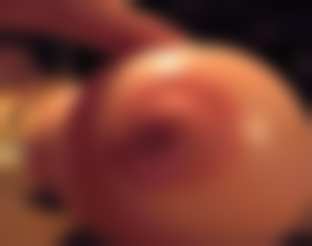 面部拉皮手术的相关知识