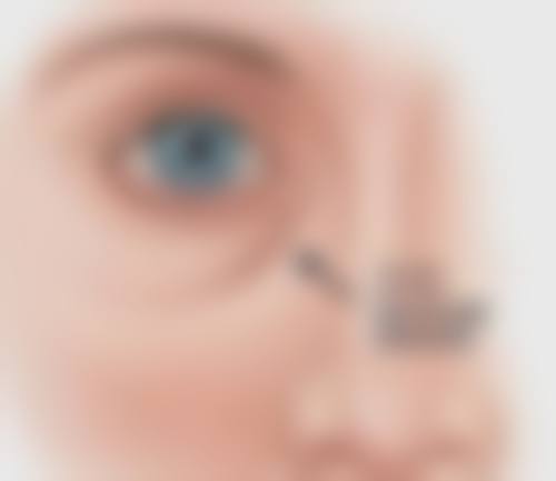 国内美白针价格