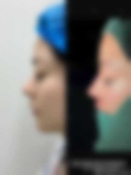 【福冈Prouge美容皮肤科患者口碑评价:】