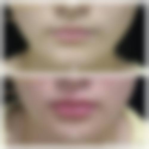 【宜昌涞曼整形医院患者口碑评价：】