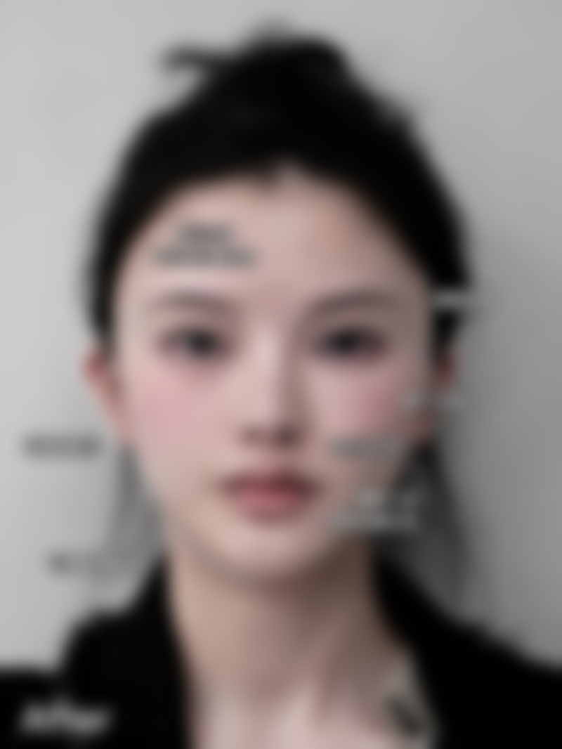 西安艺星医疗美容医院闫运涛医生的诊疗费用值不值?