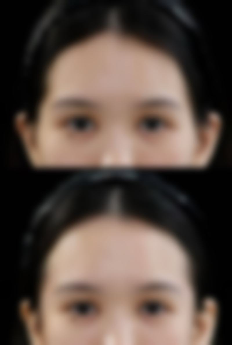 除皱针有哪些品牌