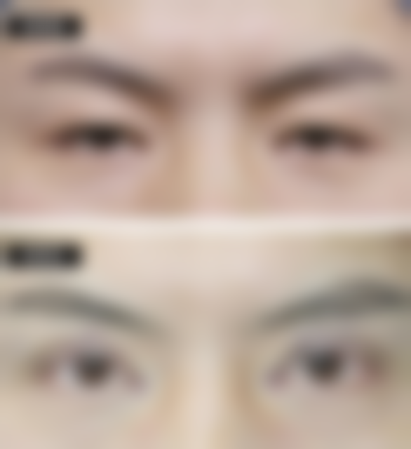 【长沙罗思整形医疗美容门诊部参考价格表:】