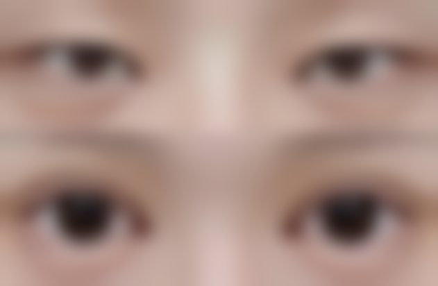 【南京光尔美整形医院诊疗设备：】