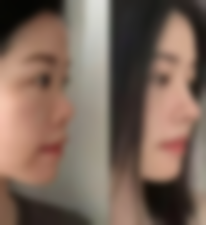 【民航广州医院整形美容科患者口碑评价：】