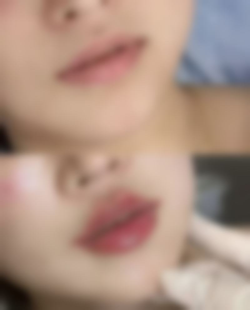 美白针打了三次没有什么效果？别慌！揭秘3大可能原因及5个提升美白成效的实用妙招！ 