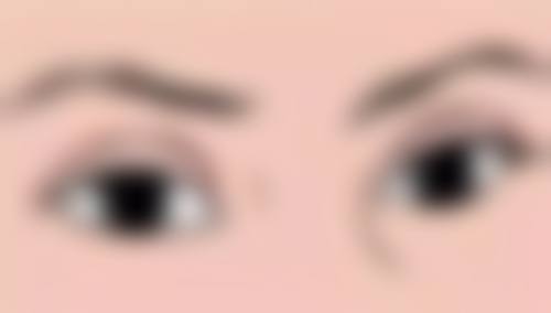 头发可以种吗？需要多少钱