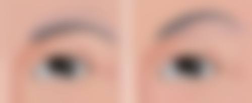 瘦脸针打几次就恒久了