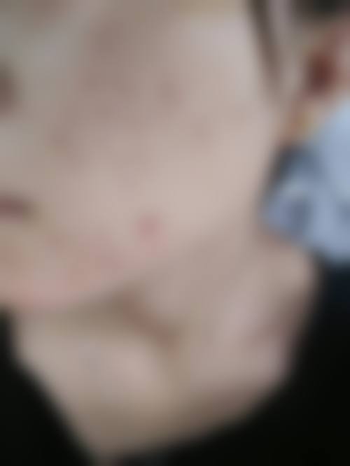 【金玟智医生擅长项目】