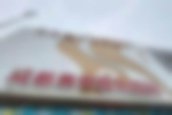 成都美容整形医院八爪鱼紧缩手术（轻度）实例/口碑