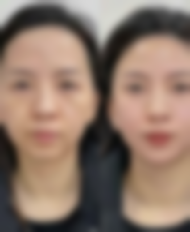 【长沙美之峰医疗美容医院特色项目：】