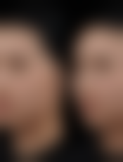 【朱京玉医生技术特点】