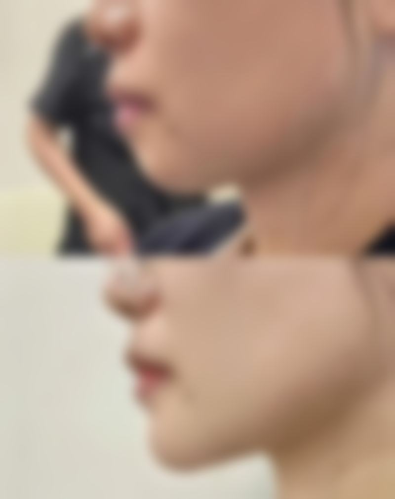 【南京美范医疗美容诊所特色项目：】