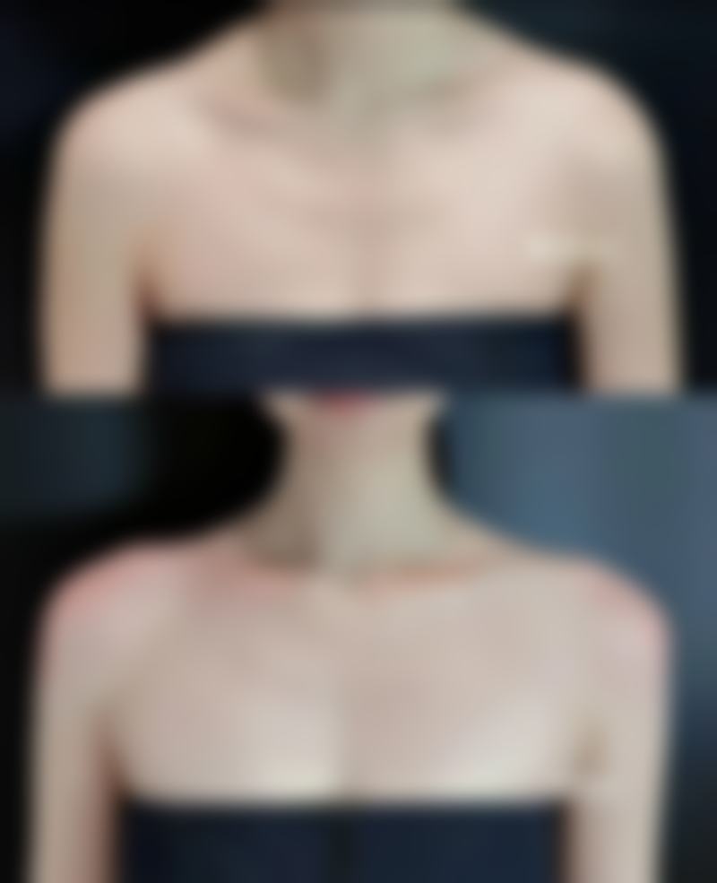 打完瘦脸多久有成效