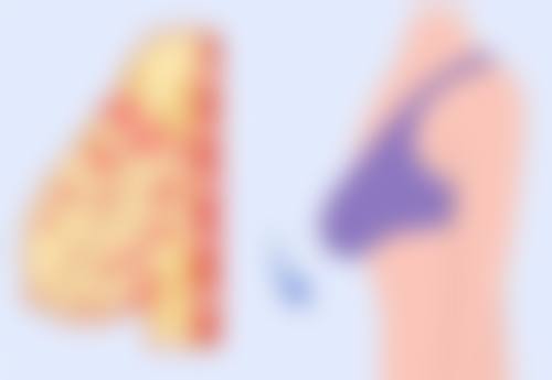 除皱针可以维持多长时间