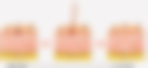 面部除皱多久有成效