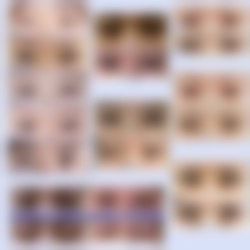 【信阳奕美整形医院诊疗设备：】