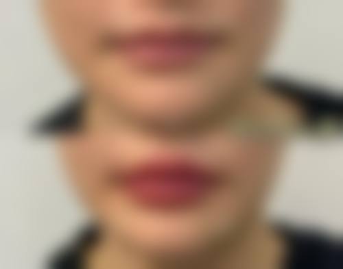 【西安诺亚壹号美都整形医院医生名单：】