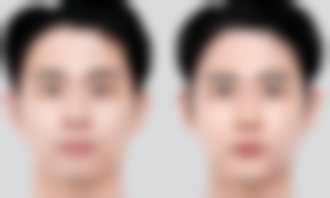 【信阳奕美整形医院特色项目：】