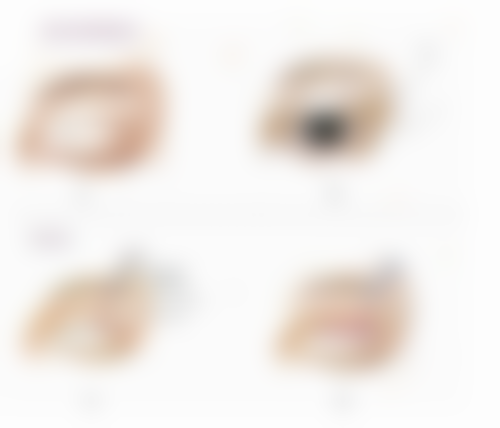 进口瘦脸针的好处