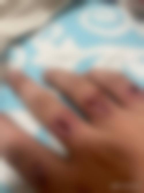 【樊芙蓉医生口碑怎么样？】