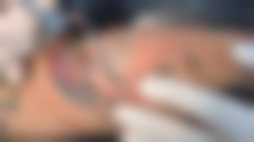 【樊芙蓉医生擅长项目：】