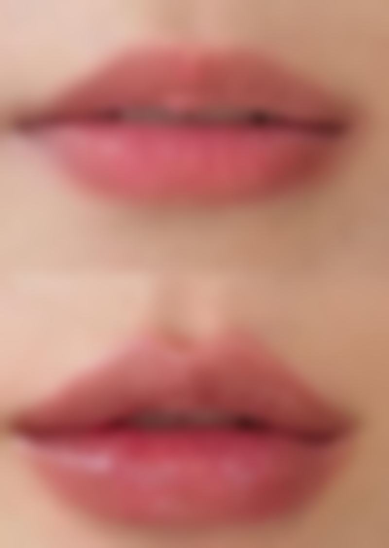 进口瘦脸针和国产瘦脸针对比