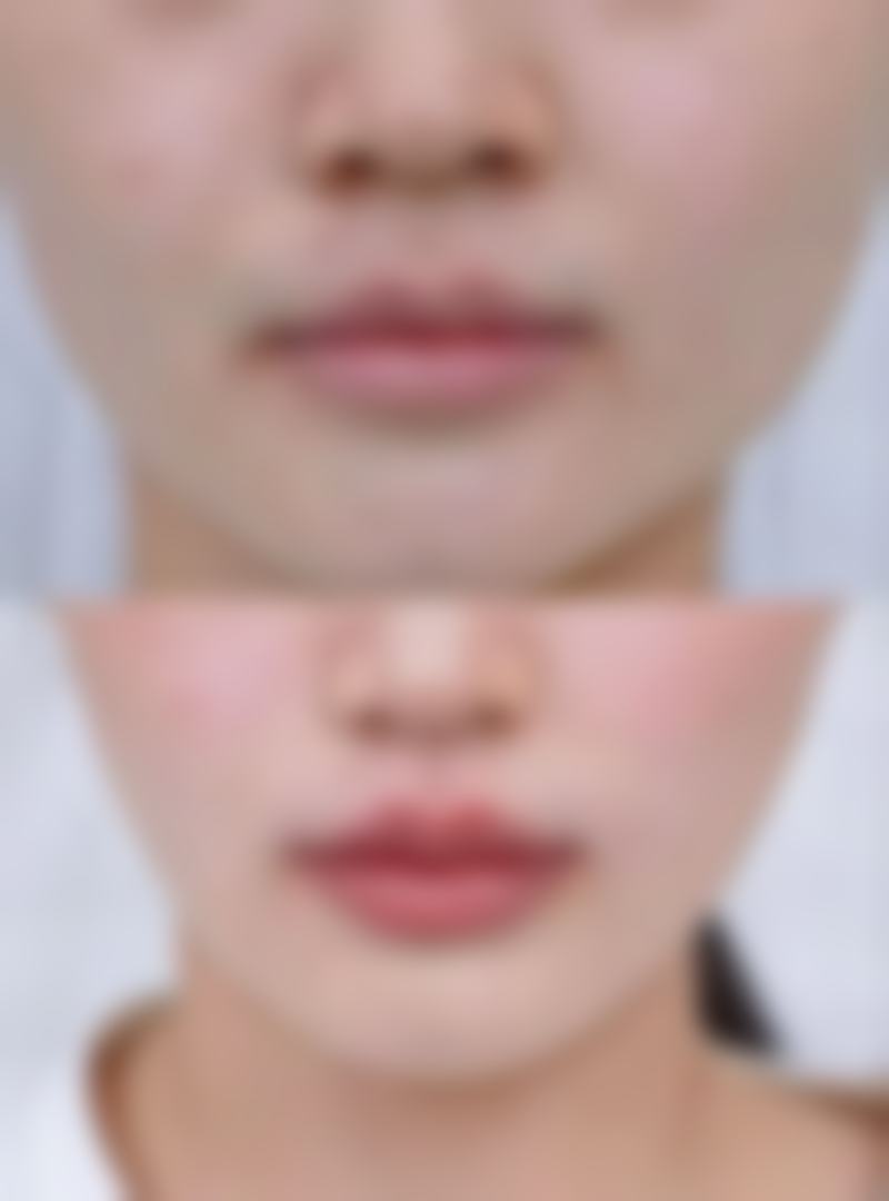 【大分Venus诊所参考价格表：】