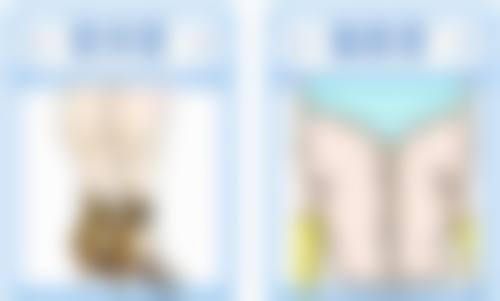 下颌不对称治疗的注意事项