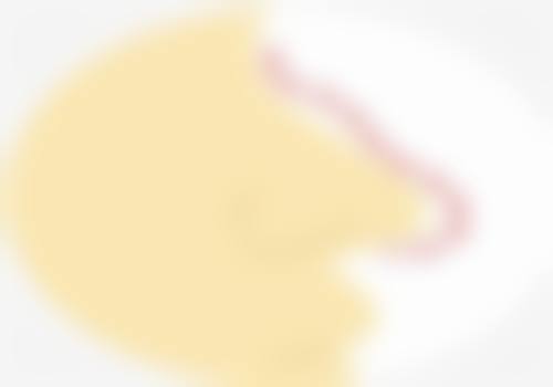 瘦脸针打完多久见效