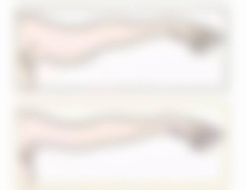 瘦脸针多久打一次成效至佳