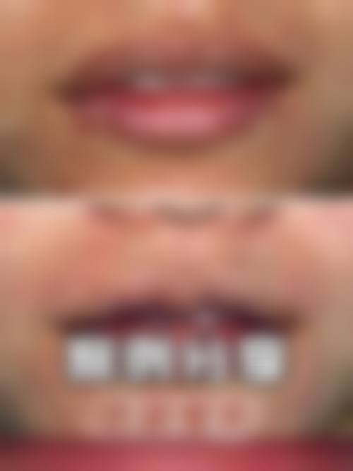 【盐亭县人民医院皮肤美容科医生团队:】