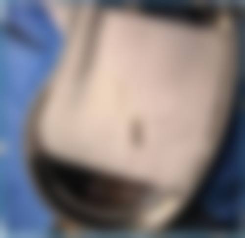 【南宁千美子整形美容诊所地址：】